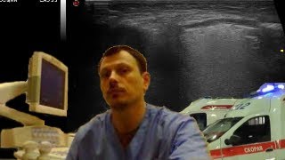 Pediatric Soft tissue ultrasound - 3 inguinal hernias screenshot 5