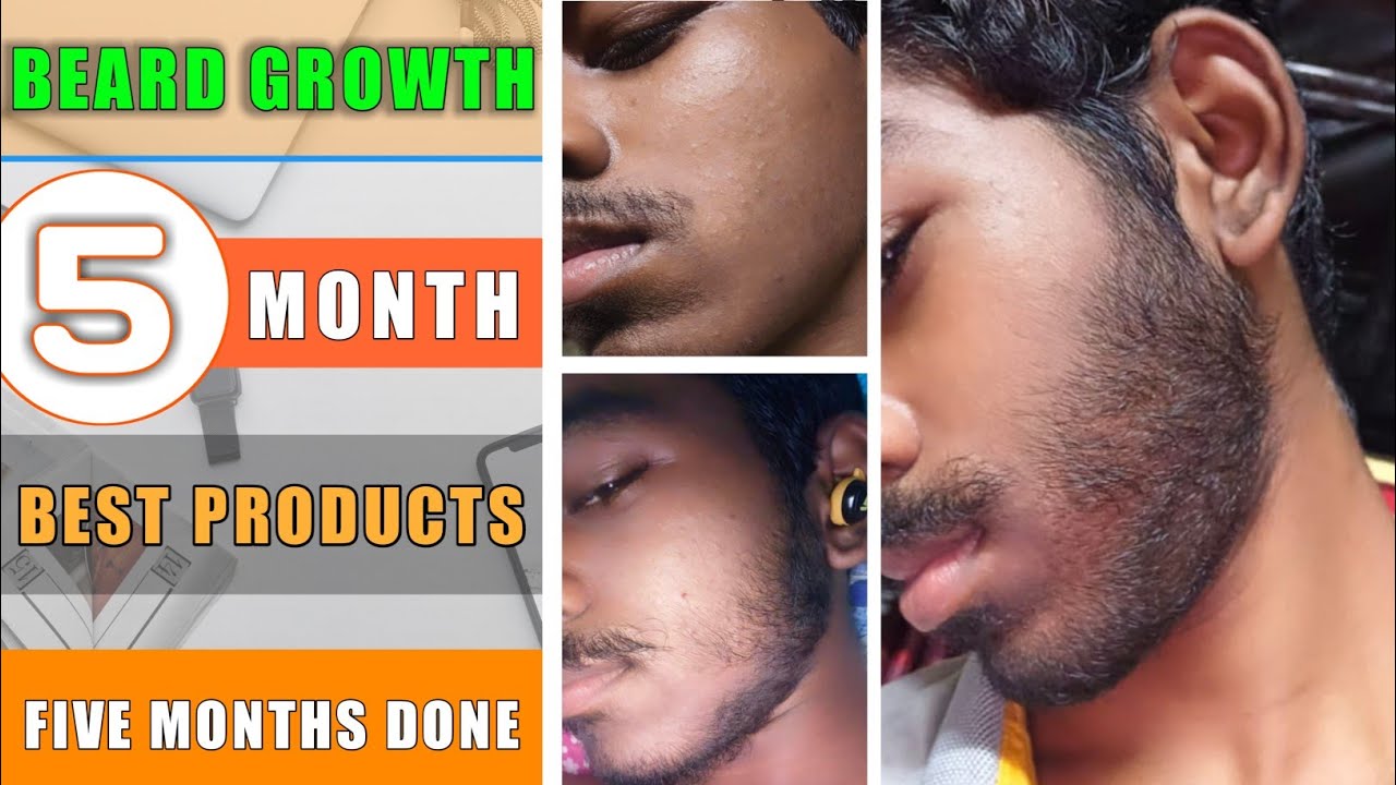 BEARD GROWTH || 5 months best results || Best products for beard growth ...