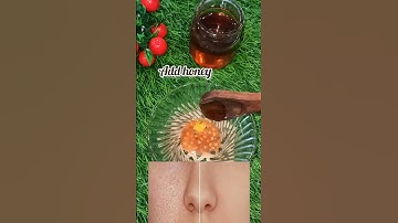 Open pores home remedy #openpores #skincare #skincaretips #ytshorts #viral #viralshorts #shorts