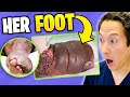 Plastic Surgeon Reacts to MY FEET ARE KILLING ME - Why Is Her Foot MASSIVE?