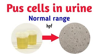 pus cells in urine normal range hpf