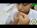 Barr body preparation from female buccal smear