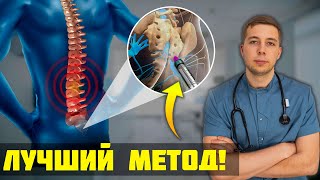 Самый ЭФФЕКТИВНЫЙ метод лечения боли в спине и ишиасе - Эпидуральная блокада!