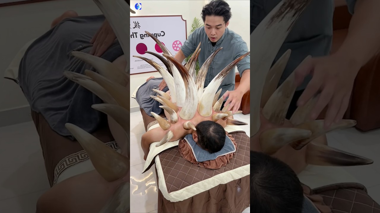 Cupping Therapy Explained #shorts