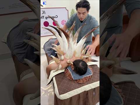 Cupping Therapy Explained #shorts