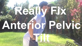 How To Really Fix Anterior Pelvic Tilt Hyperlordosis - Over Extension