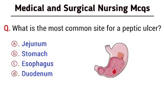 Medical and Surgical Nursing Mcq | medical and surgical questions and answers | nursing mcq screenshot 3
