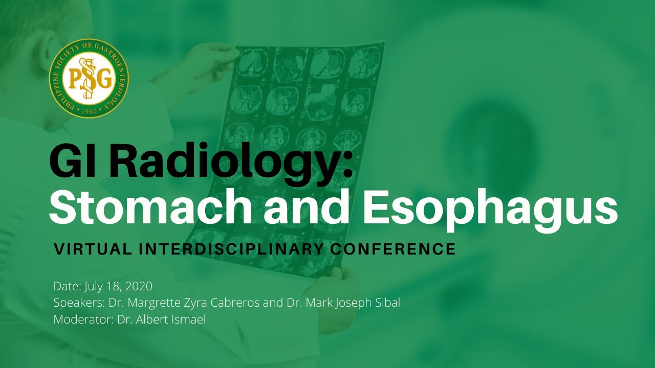 GI Radiology: Esophagus and Stomach - YouTube