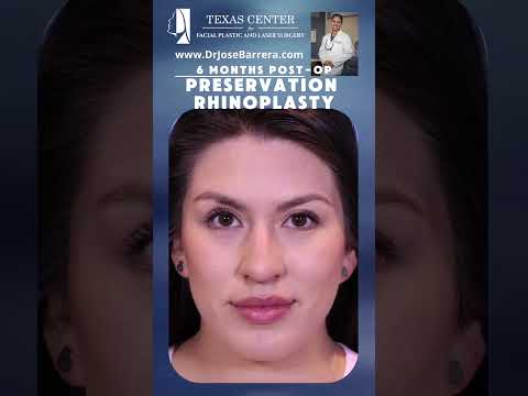 Video thumbnail: The best nose job is the one nobody knows you had. 🤫 — Dr. Jose Barrera