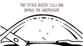 Viscoelástico Ophteis Fr Pro De Rayner- El Único Ovd Con Sorbitol