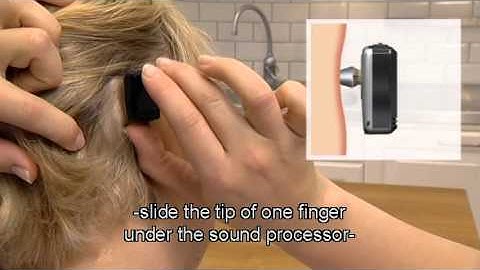 Baha - Removing the sound processor