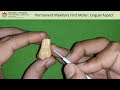 lingual aspect of Permanent maxillary first molar