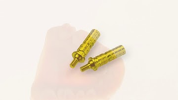 How to use the MIS CONNECT one-time abutment