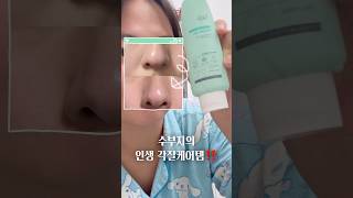 ⭐️9년째 사용 중인 필링젤⭐️(자극❌)   #피지관리