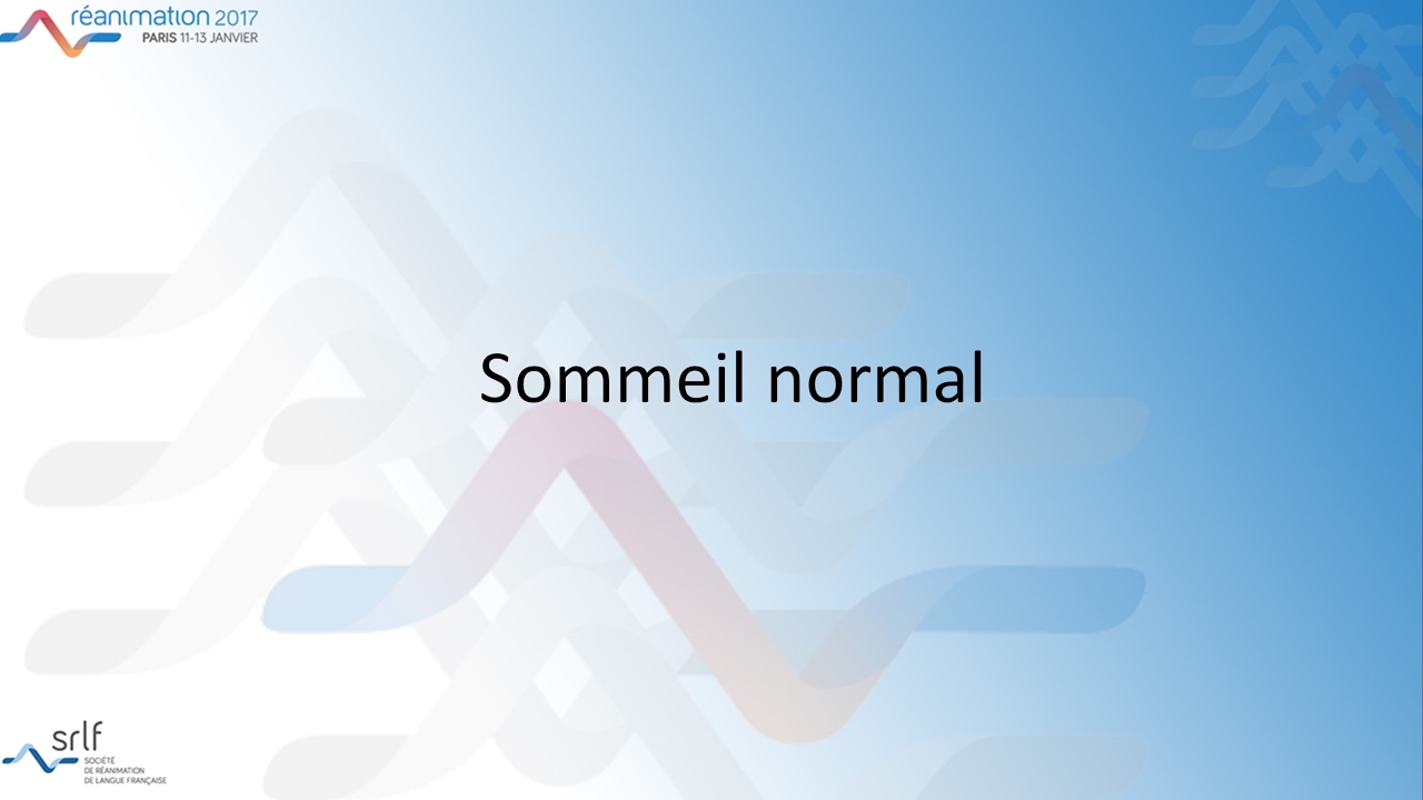 Réanimation 2017 - Sommeil atypique et privation de sommeil en réanimation I. ARNULF