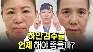 하안검 몇살에 효과적인가요? 하안검 연령, 수술시기, 흉터, 재수술 | 나이 들어 보이는 눈 밑 고민될 때 보세요