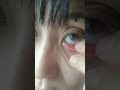 恐怖！キモイ！目に髪の毛が。A werid video ! Mystery of body.