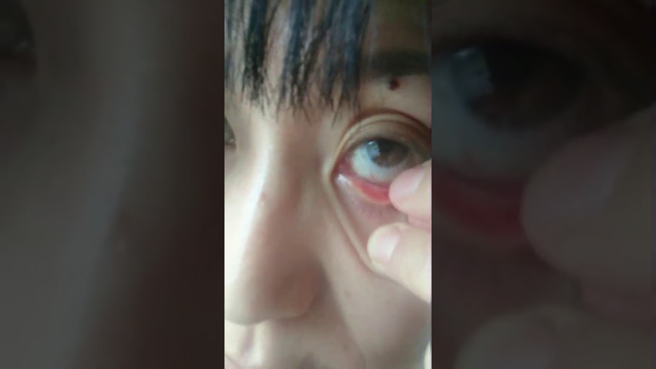 恐怖 キモイ 目に髪の毛が A Werid Video Mystery Of Body Youtube