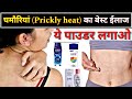 घमौरियों का सबसे अच्छा ईलाज // Prickly heat treatment // summer acne // Yogesh medicare