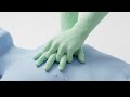 Hands only CPR