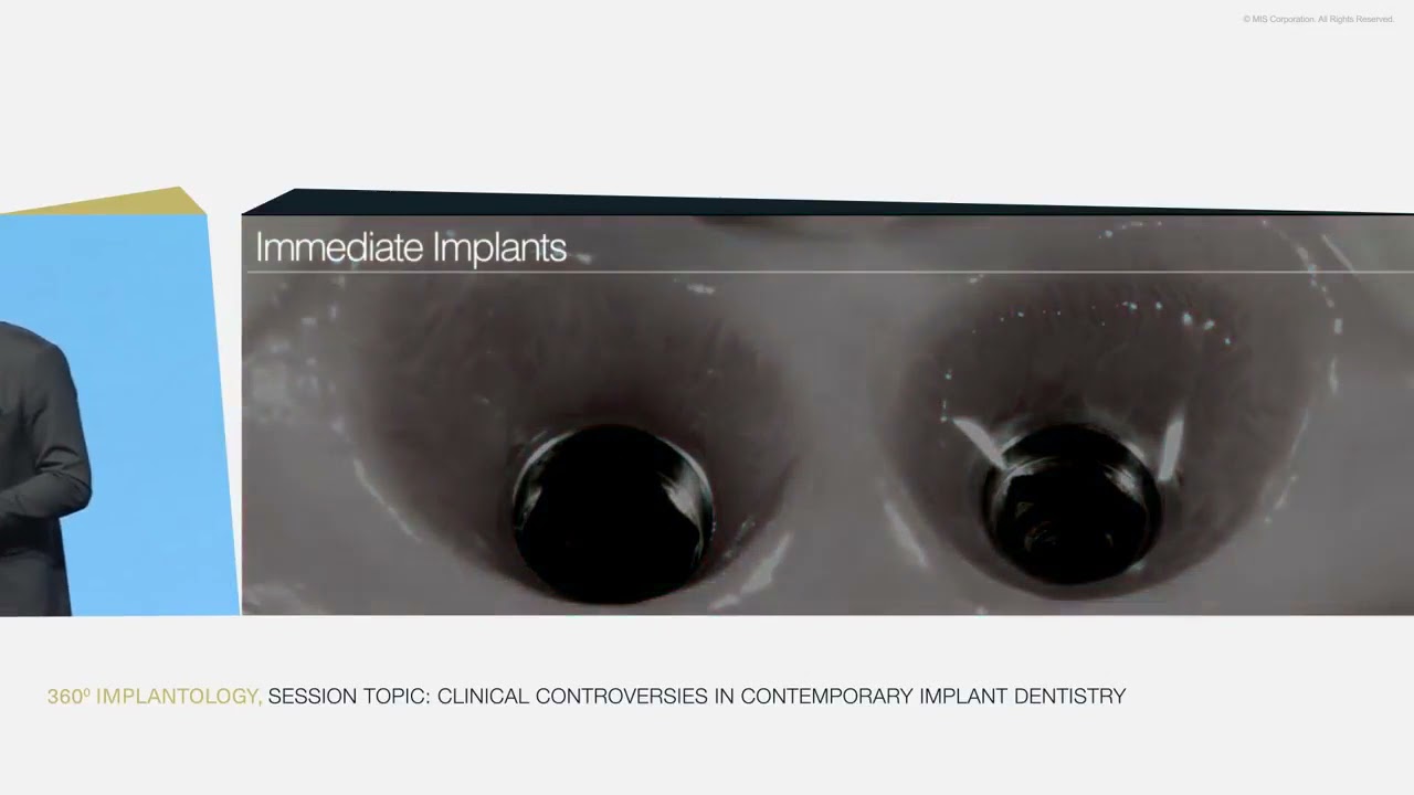 Key Factors for Success with Implants in the Aesthetic Zone