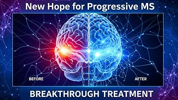 New Hope for MS: A 2025 NEW Treatment That Can Slow Disability Progression