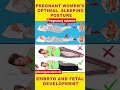 Best sleeping position for women during pregnancy🚑 #ritiksarojkachhidih