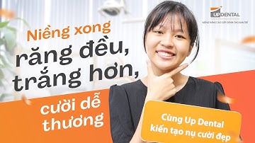 Review kết quả niềng răng của Minh Thư #295