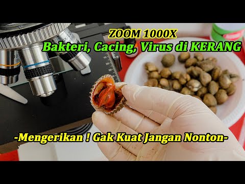 ZOOM 1000X: KERANG