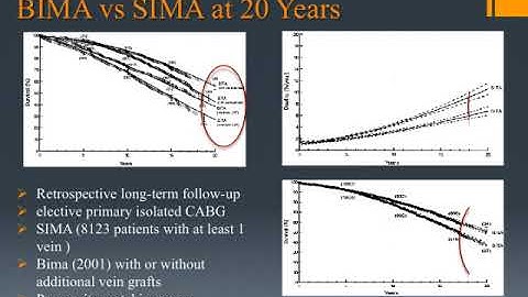 total arterial revascularization personal strategy