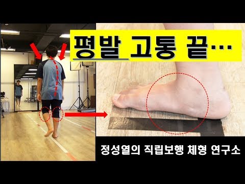 평발통증 끝 평발교정운동 원리를 알고 실천 하면 극복 할 수 있다.(바른걷기운동,바른자세,걷기운동방법)
