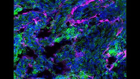 Webinar Replay -  Digital pathology of high multiplex imaging