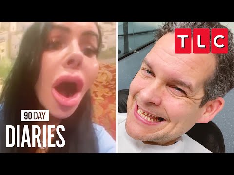 Tom's New Teeth | 90 Day Diaries | TLC