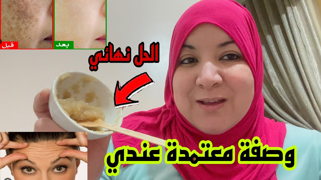 2 ингредиента 💁‍♀️ Мощный рецепт, который избавит вас от пигментации кожи и темных пятен, а также...