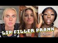 LIP FILLER PRANK | Part 2 | TikTok Compilation