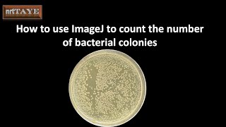How to use ImageJ software to count the number of bacterial colonies