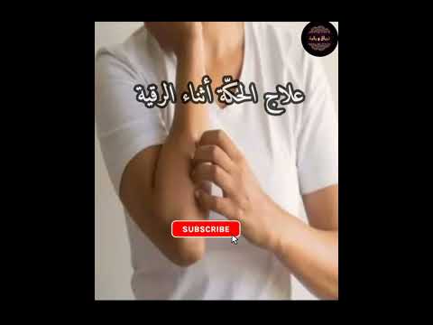 الحكة أثناء الرقية على ماذا تدل التنميل في الأطراف علاج الحكة والتنميل سعود العواد الشعباني