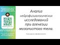 Тема: Анализ нейрофизиологических исследований при агенезии мозолистого тела.