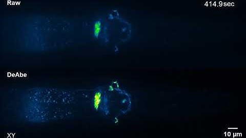 New AI technique generates clear images of thick biological samples without the fancy hardware