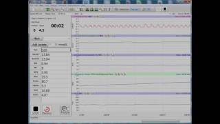 MCGS 05 - VO2 Max Test