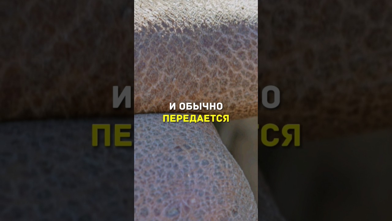 Просто о лечении ихтиоза #shorts