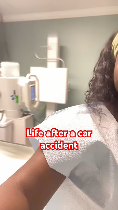 Navigating life after a hit and run car accident. Getting Full Body XRay Done #shorts #subscribe