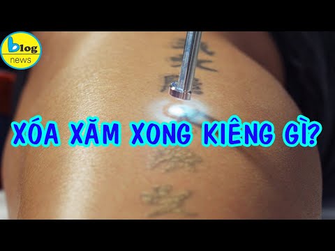 Video: Cách Chăm Sóc Hình Xăm Trong Khi Xóa: 12 Bước (Có Hình)