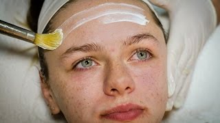 TOVA BEAUTY טיפולי אקנה נעורים ומתבגרים
