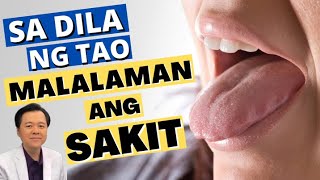 Sa Dila ng Tao, Malalaman ang Sakit  - Payo ni Doc Willie Ong #1336