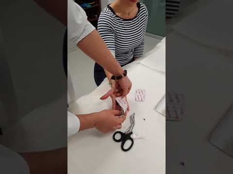 TAPING FOR CARPAL TUNNEL SYNDROME - JORGE VILLARAN ZERDA (SPORTS MEDICINE DOCTOR)