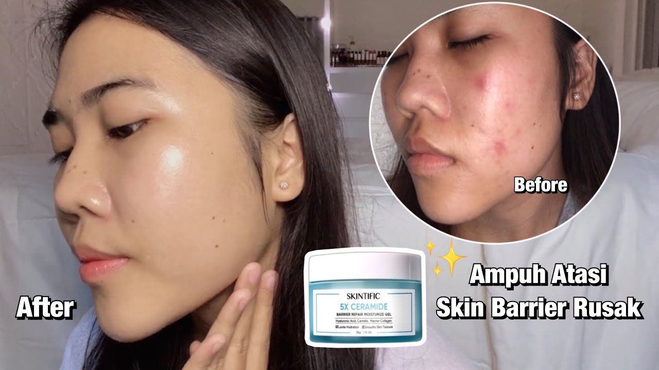 Rekomendasi Moisturizer Paling Ampuh Atasi Skin Barrier Rusak