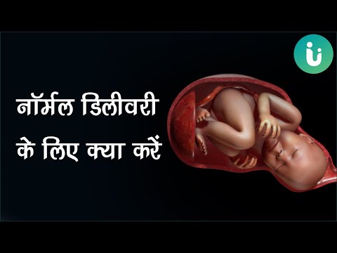 वीडियो: मानक संयंत्र दिशानिर्देश: एक मानक के रूप में बढ़ने के लिए एक पौधे को कैसे प्रशिक्षित करें