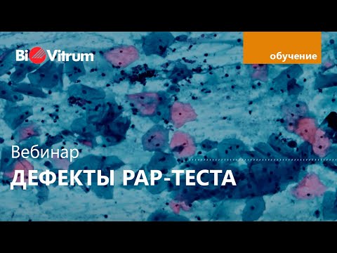 Дефекты окраски по Папаниколау