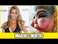 Hollywood No Quiere Que Veas: 20 Rostros Arruinados Por El Bisturí!